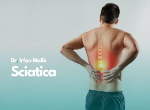 Sciatica (3)