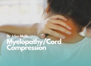 Myelopathy - Cord Compression