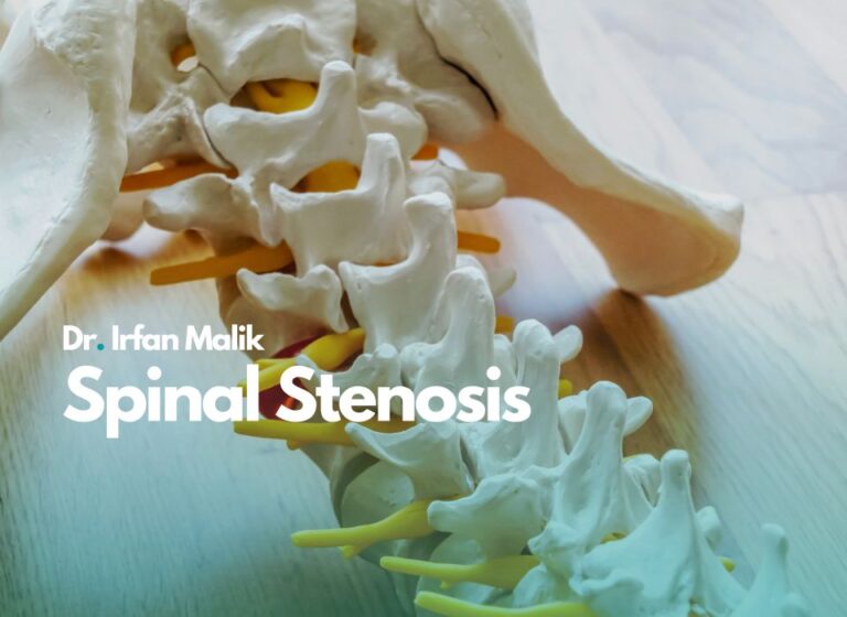 Spinal Stenosis