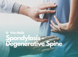 Spondylosis - Degenerative Spine