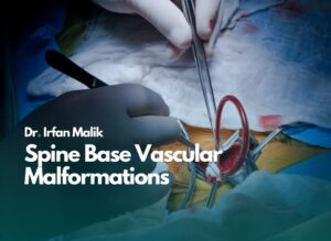 Spine Base Vascular Malformations